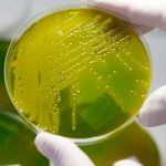 Crean bacteria fluorescente para detectar minas antipersonales