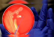 Nueva molécula abre la vía para acabar con resistencia de superbacterias