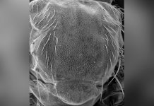 ¿Qué tiene que ver el pelo de las moscas con el cáncer?
