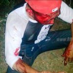 Cuatro lesionados en accidente de tránsito en Nandaime