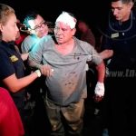 Choque entre motociclistas deja a uno lesionado