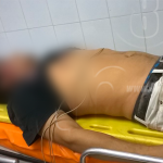 Hombre muere después que camión le pasara encima