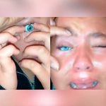 Video: Usó ojo de una muñeca como lente de contacto