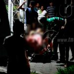 Ometepe: Menor es atropellada por motociclista