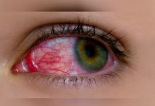 Inventan un pegamento que permite curar temporalmente heridas en los ojos