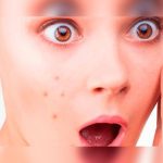 6 tipos de granos y cómo tratarlos según dermatólogos