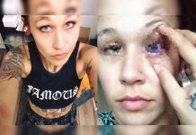 Facebook: modelo que se tatuó el ojo revela el terrible resultado de su acción