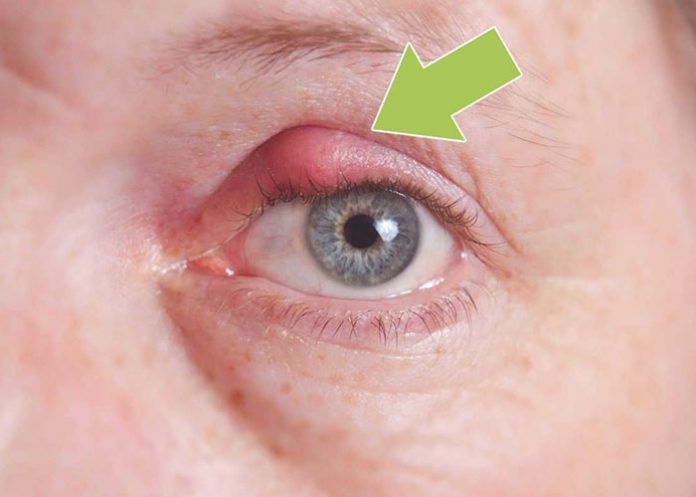 ojos1