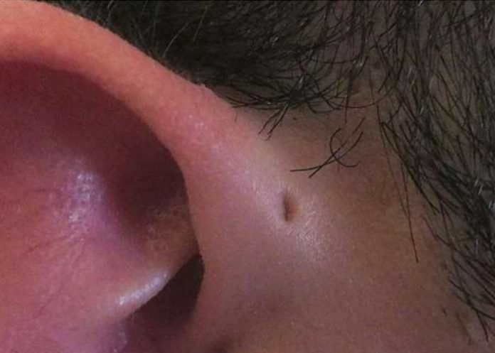 oreja1