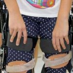 sensor cerebral, cientificos, descubrimiento, tetrapléjicos,