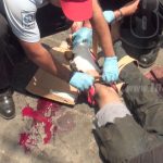 Managua: Motociclista con fractura en el pie tras accidente