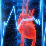 Inteligencia artificial logra predecir infartos