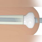 Una prótesis de mano «que ve» ofrece nuevas esperanzas a los amputados