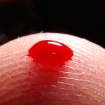 Un análisis de sangre para el autismo