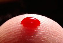 Un análisis de sangre para el autismo