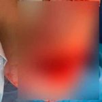 ¡Dantesco! Joven termina mordida por un pez en playa de Puerto Rico (Fotos) fotos, puerto rico, pez, mordida, playa, insolito,