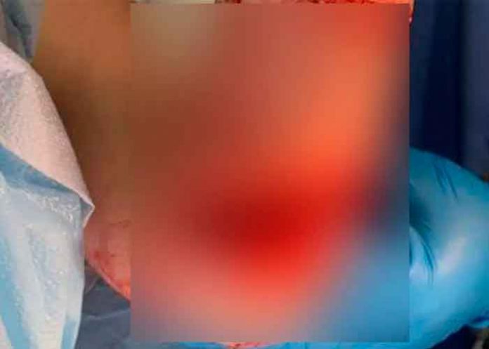 fotos, puerto rico, pez, mordida, playa, insolito,