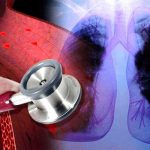 Científicos lusos hallan molécula que predice hipertensión arterial pulmonar