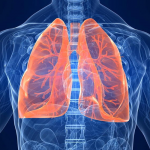 ¡Increíble! Una mujer ha vivido décadas con aceite en sus pulmones