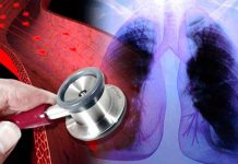 Científicos lusos hallan molécula que predice hipertensión arterial pulmonar