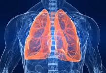¡Increíble! Una mujer ha vivido décadas con aceite en sus pulmones
