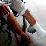 Ometepe: Delincuentes agreden a joven para robarle