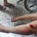 León: Delincuentes casi matan a una joven por robarle el celular