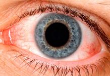 Síndrome del ojo seco: qué lo provoca y cómo evitarlo en el trabajo