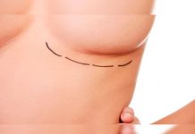 Cinco dudas frecuentes para despejar antes de operarse los senos