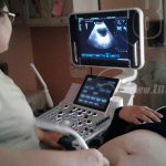 Jornada de ultrasonidos en homenaje al comandante Chávez