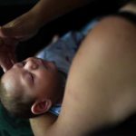 Cifra de defectos por zika en EEUU es similar a otros sitios
