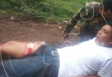 Policía tica hiere de bala a nicaragüense en frontera sur