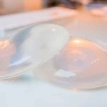 ¿Cómo afectan las superficies de los implantes mamarios al sistema inmunitario? salud, estudio, implantes mamarios, efectos, linfoma