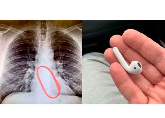 estados unidos, sobreviviente, hombre, tragar, airpods, dormido,