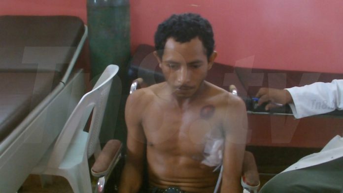 Baleado-Siuna