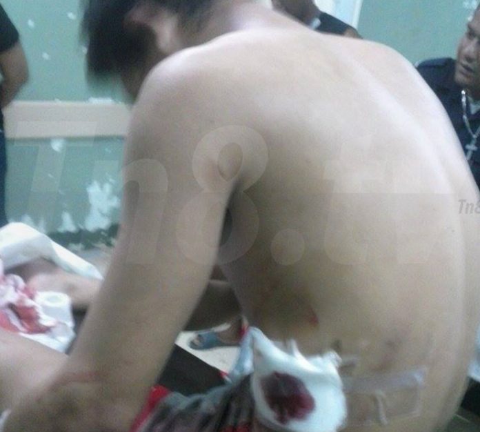 Bombero-Bluefields