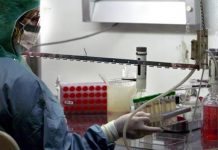 Niño muere tras contraer ántrax en Rusia