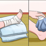 ¿Por qué no se debe tomar alcohol cuándo te fracturas un hueso?