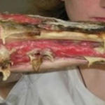 Preocupación por nueva droga que se come la piel