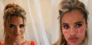 australia, influencer, tutorial, video, tik tok, afectaciones, piel,
