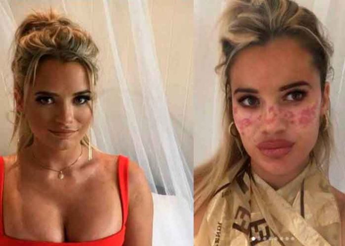 australia, influencer, tutorial, video, tik tok, afectaciones, piel,