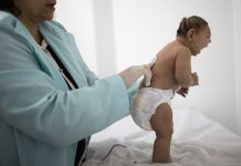 Nace primer bebé con microcefalia vinculada al zika en Florida