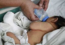 Honduras: Registran 55 recién nacidos con microcefalia