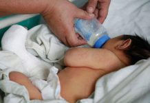 Otro caso de microcefalia en Honduras