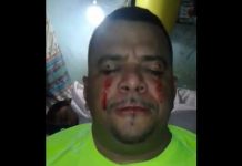 Panamá: Reo se cose los ojos y labios en protesta (video)