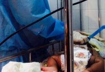 Honduras: Aumentan a 28 los casos de niños con microcefalia