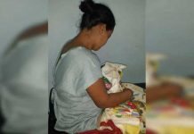 Honduras: Otro caso de microcefalia vinculado al zika