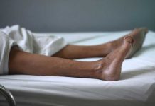 Guatemala confirma casos de Guillain-Barré y microcefalia