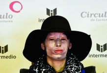 Condenan en Colombia a agresor con ácido a mujer