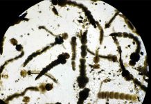 Muestran vínculo entre Zika y Guillain-Barre